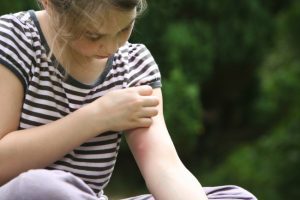 3 Mosquito Control Tips to Help Protect Yourself From Getting Bitten